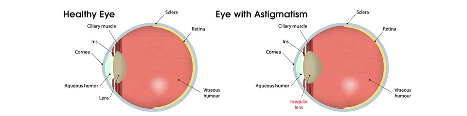 affordable eye exam