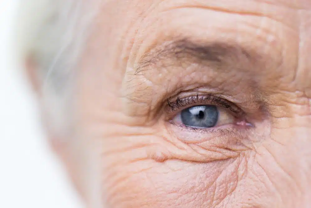 senior eye conditions